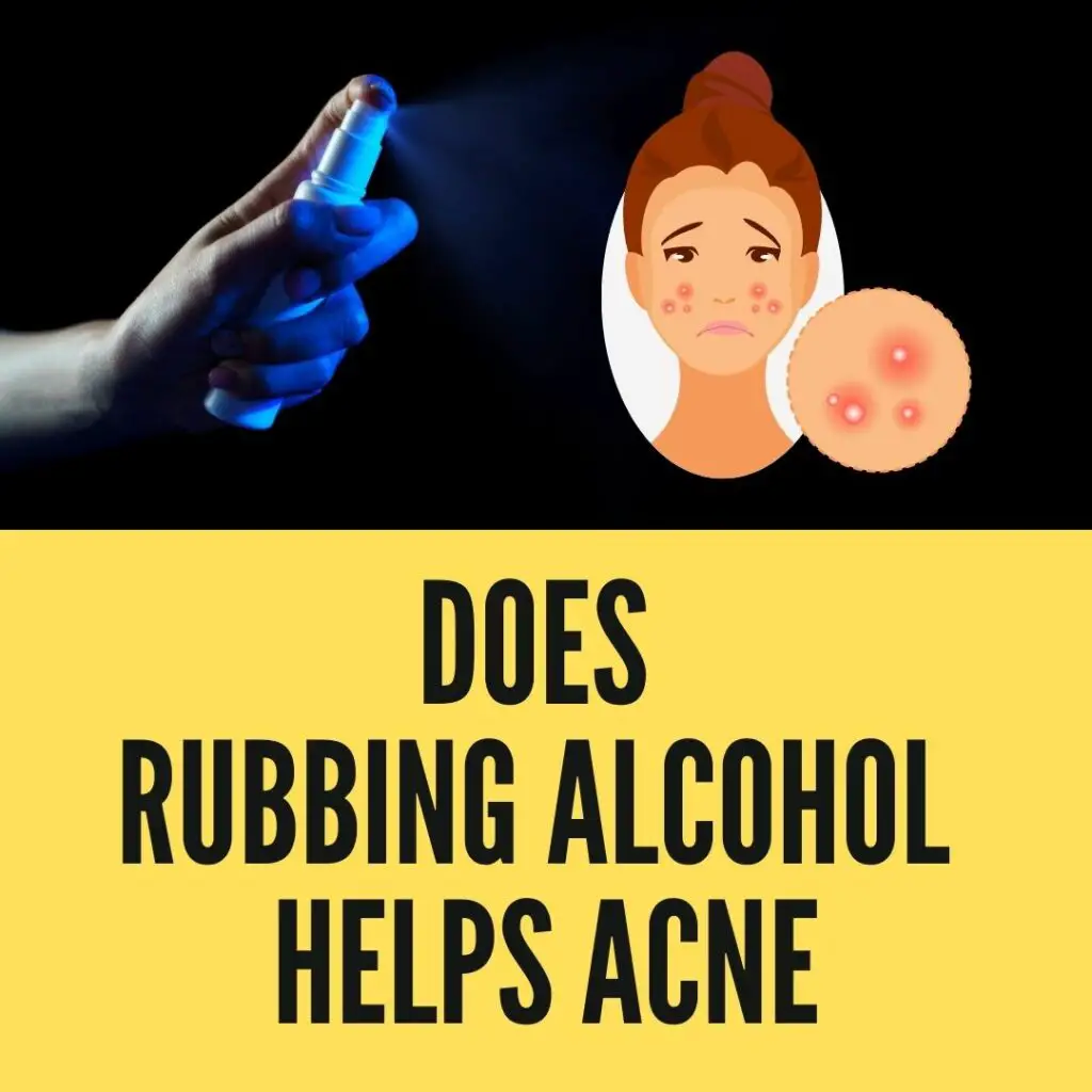 Does Rubbing Alcohol Help Acne