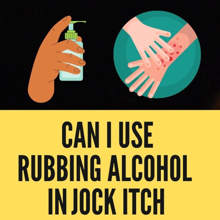 does rubbing alcohol get rid of jock itch